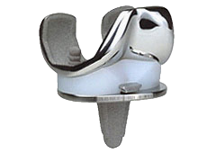 Kniegelenksimplantat - Kniegelenksprothese